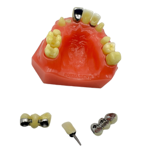 Vintage Formadent Dental Procedure Model