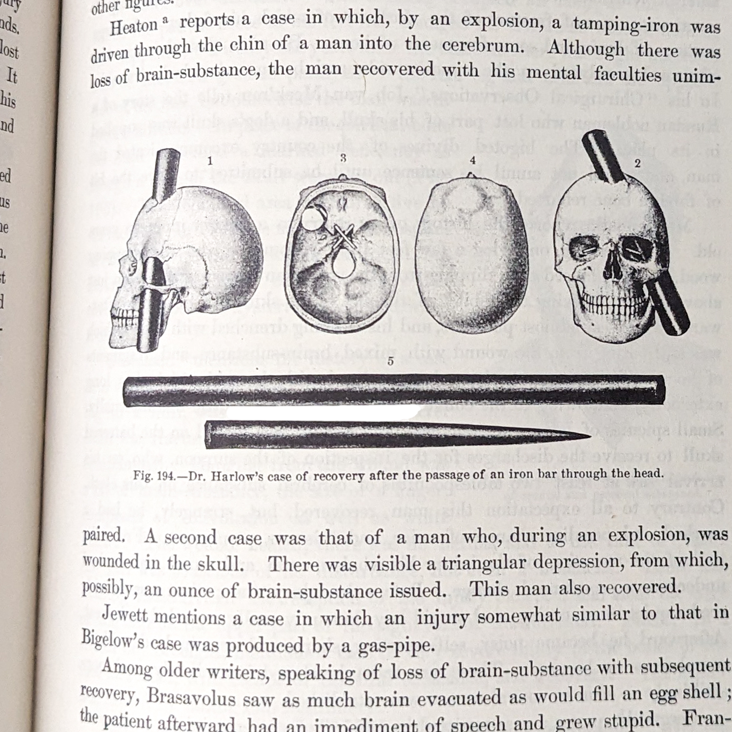 Vintage Illustrated Medical Book: Anomalies & Curiosities of Medicine