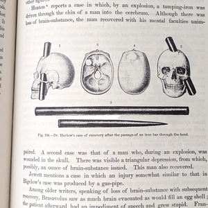Vintage Illustrated Medical Book: Anomalies & Curiosities of Medicine