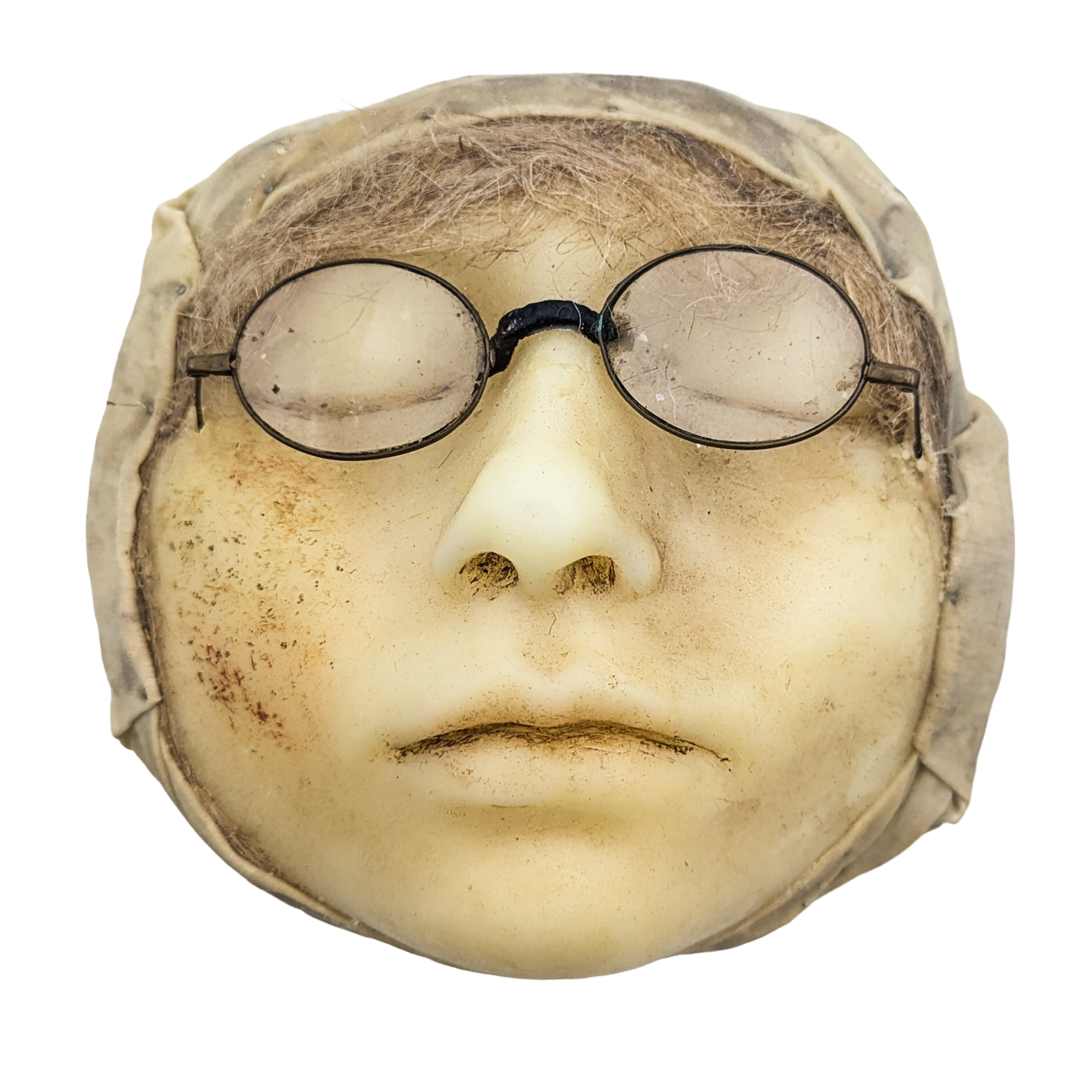 Antique Moulage Wax Pathology Face Model