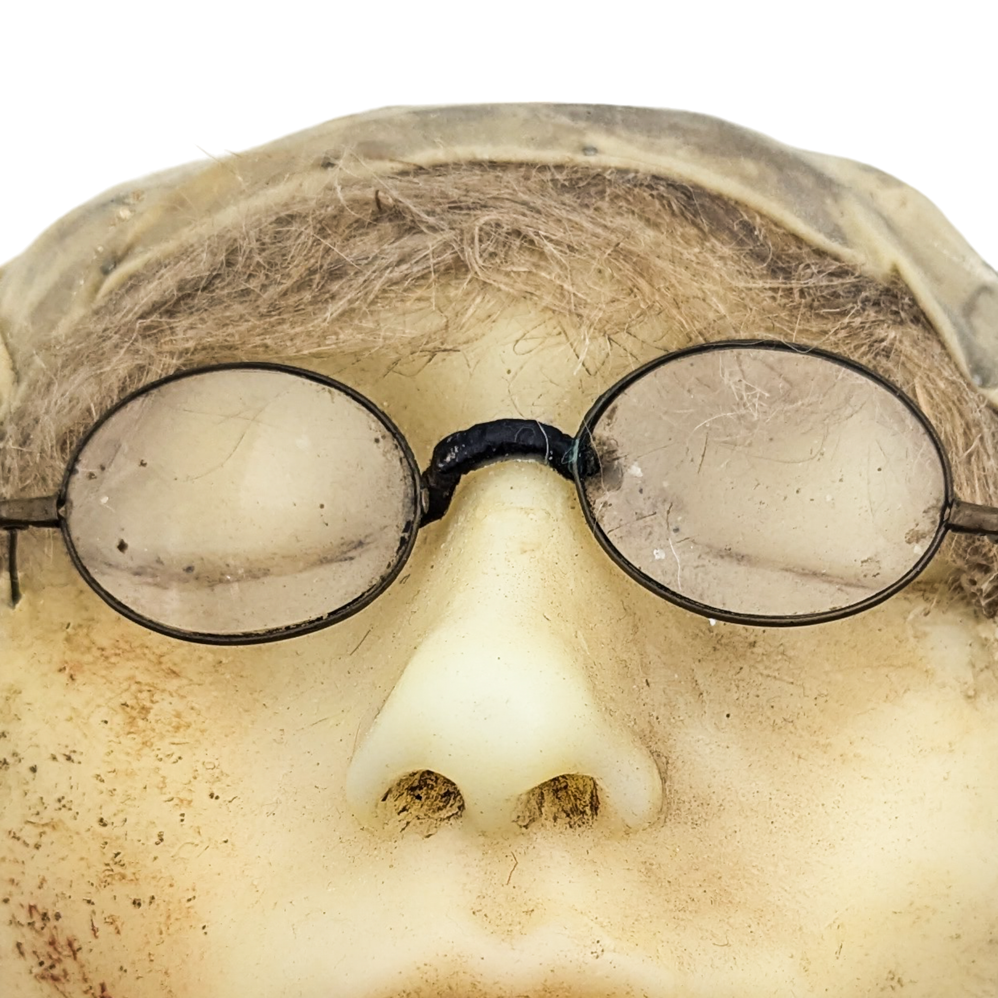 Antique Moulage Wax Pathology Face Model