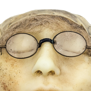 Antique Moulage Wax Pathology Face Model