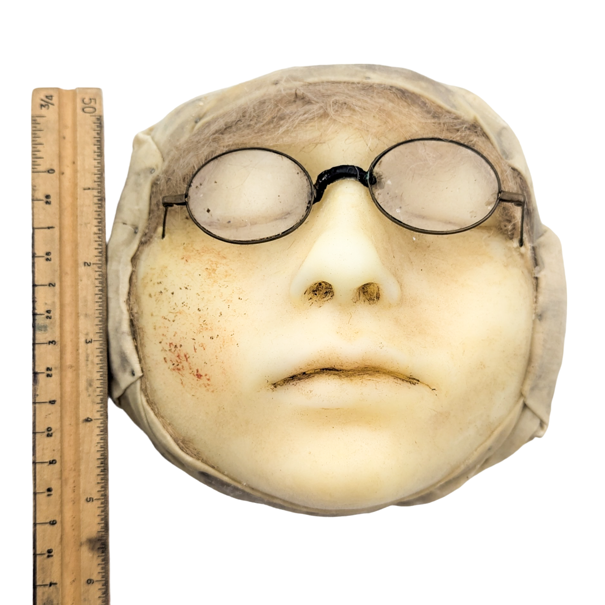 Antique Moulage Wax Pathology Face Model