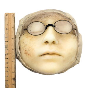 Antique Moulage Wax Pathology Face Model