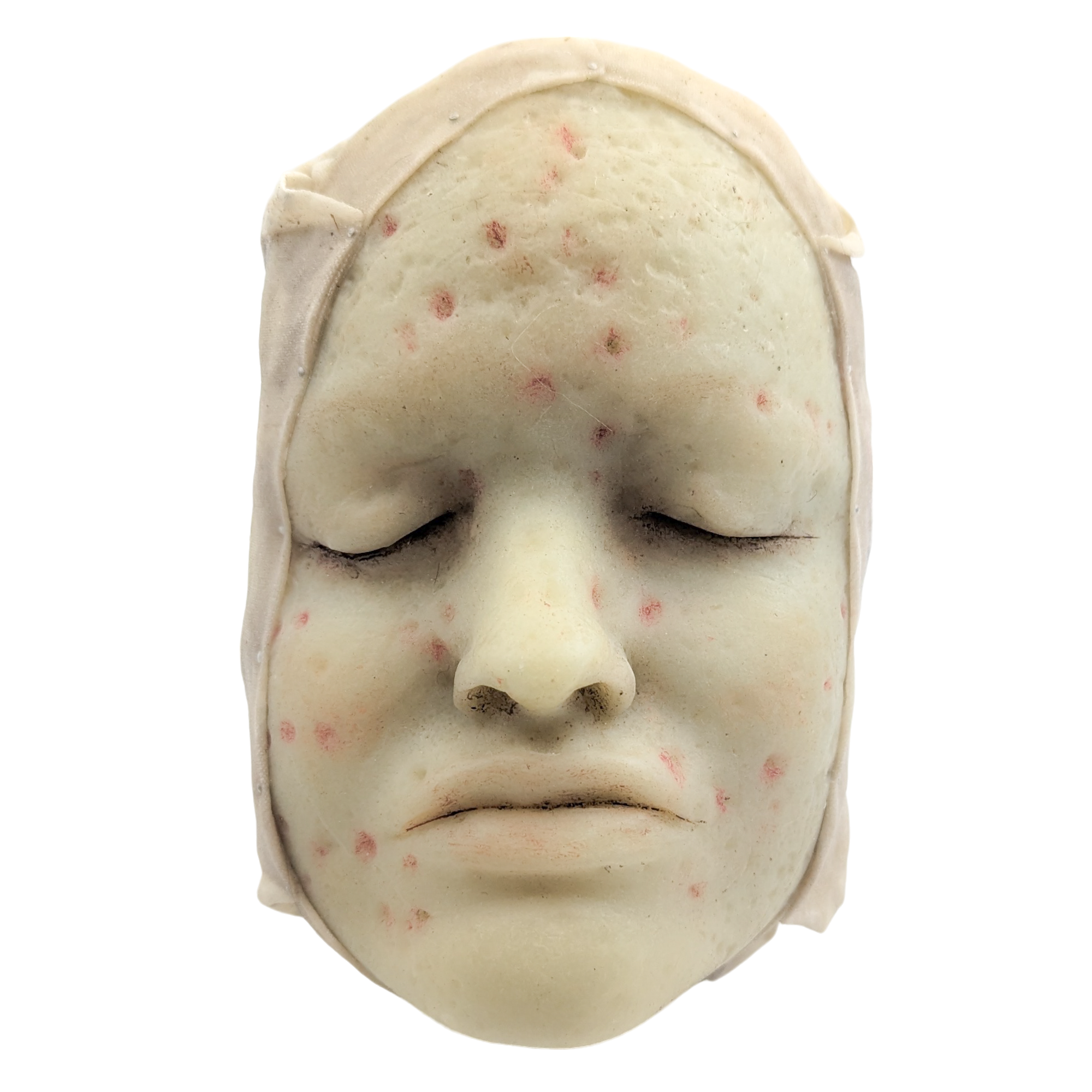 Antique Moulage Wax Pathology Model Face