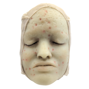 Antique Moulage Wax Pathology Model Face