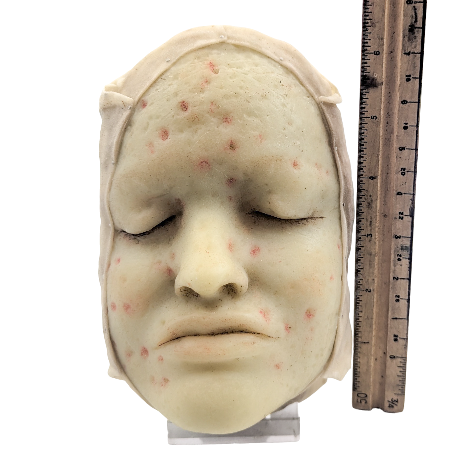 Antique Moulage Wax Pathology Model Face