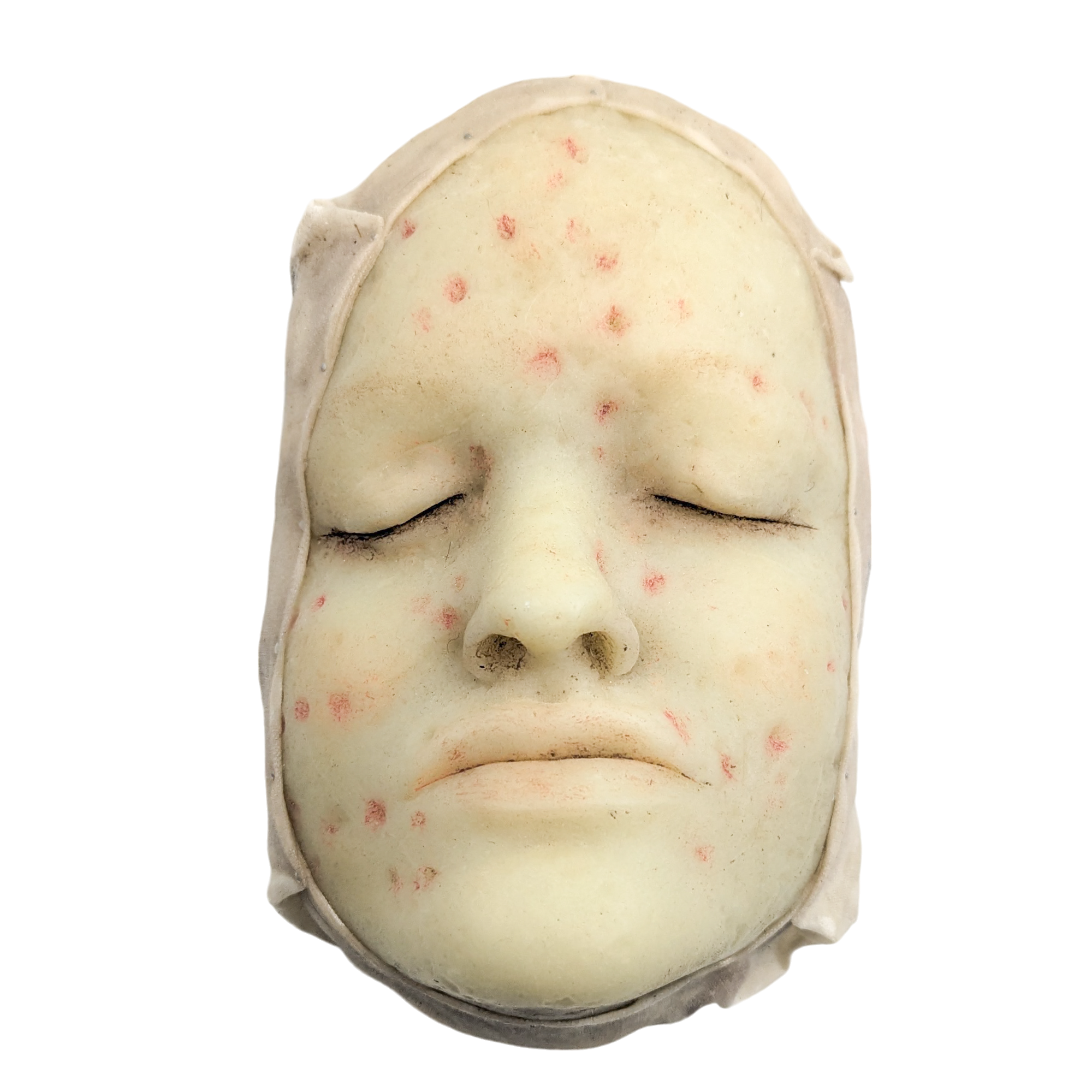 Antique Moulage Wax Pathology Model Face