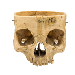 Real Partial Human Skull