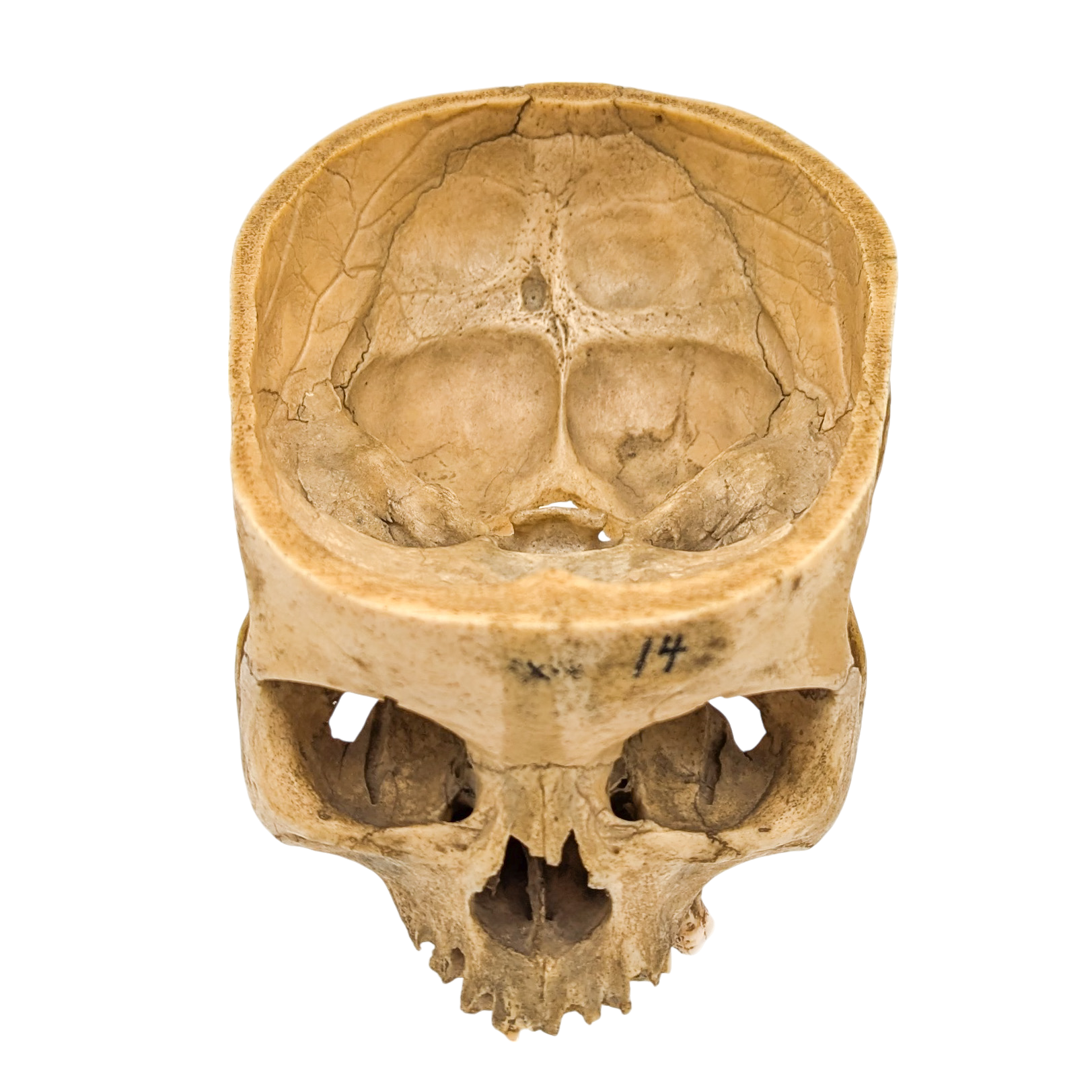 Real Partial Human Skull