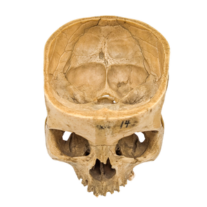 Real Partial Human Skull