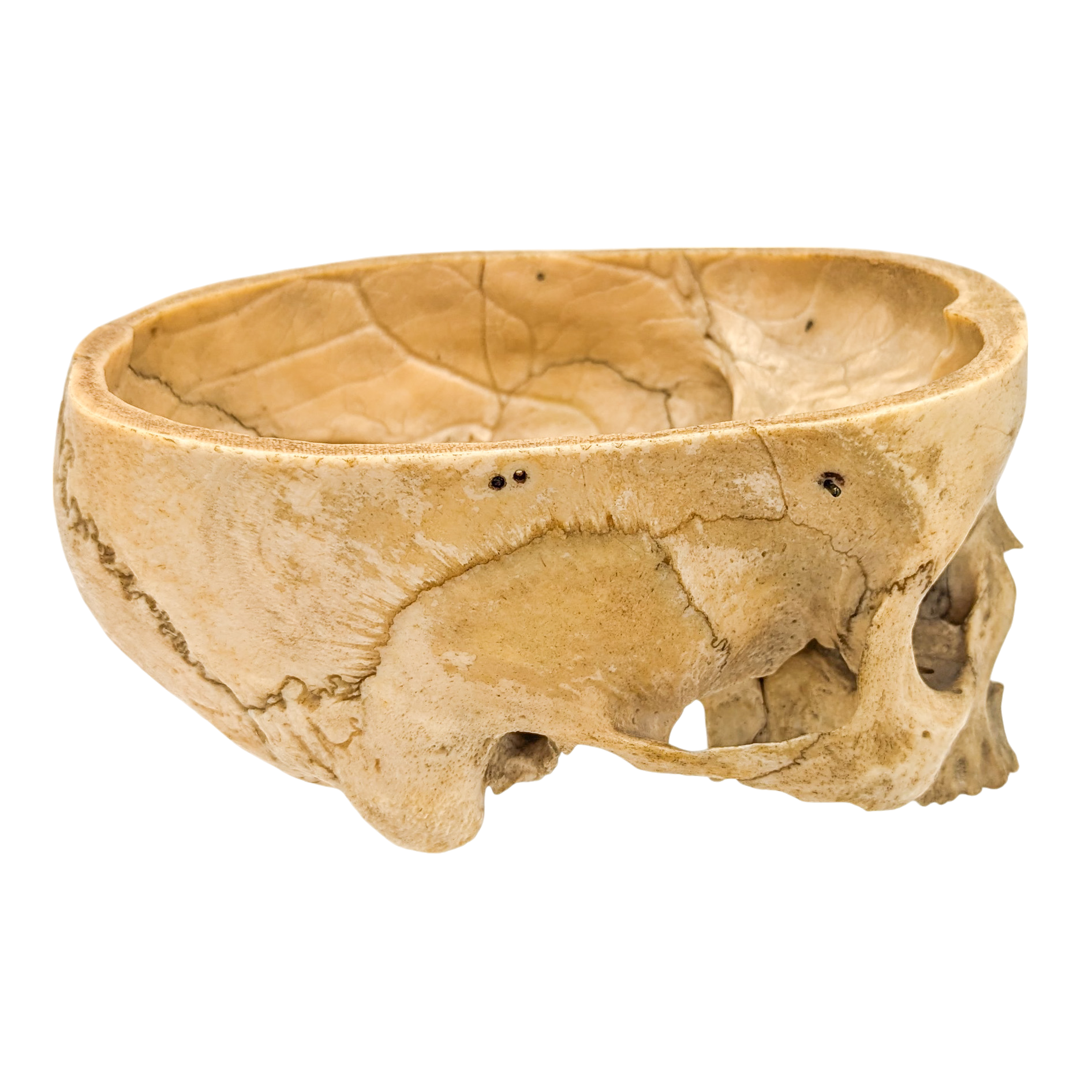 Real Partial Human Skull