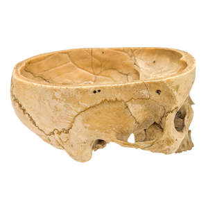 Real Partial Human Skull