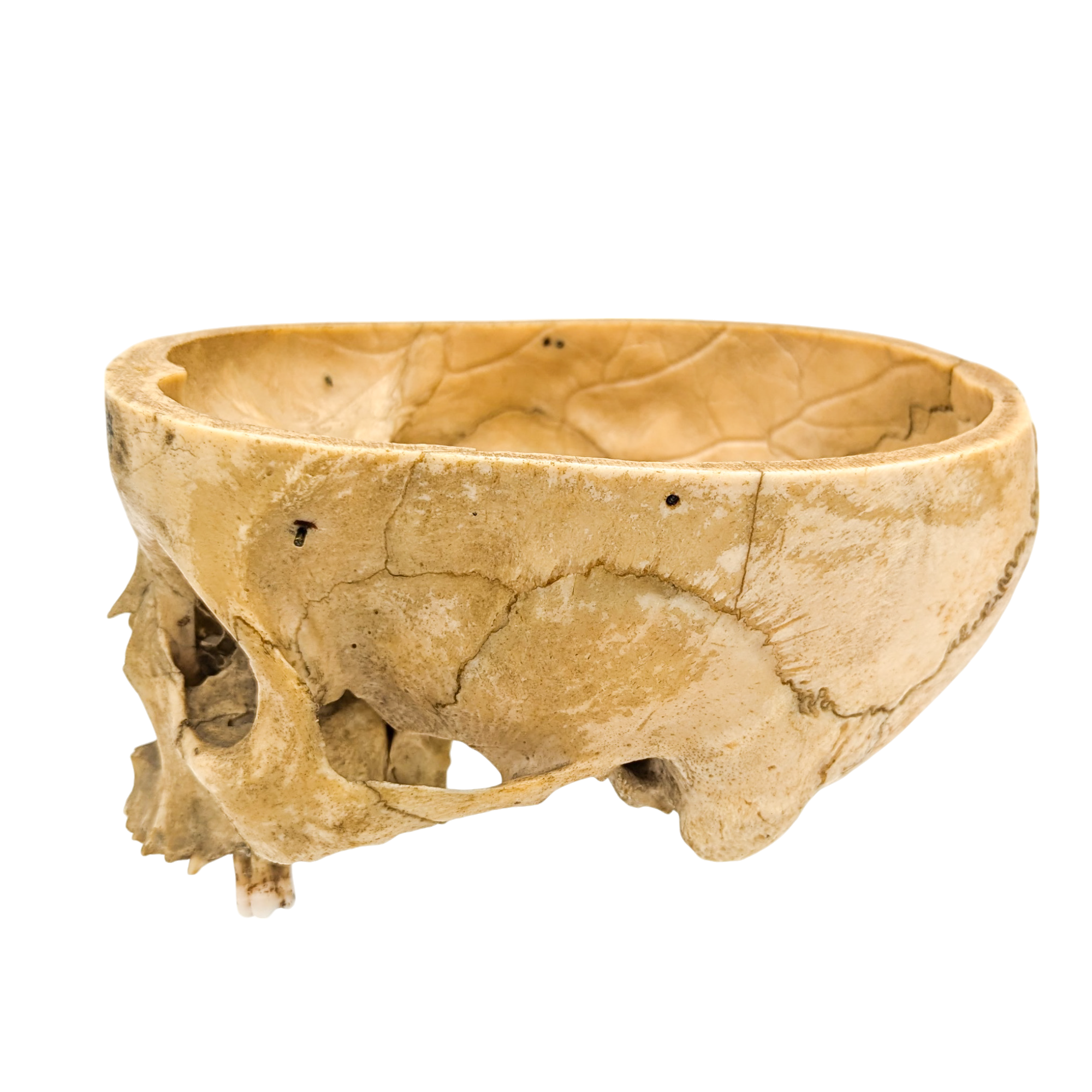 Real Partial Human Skull