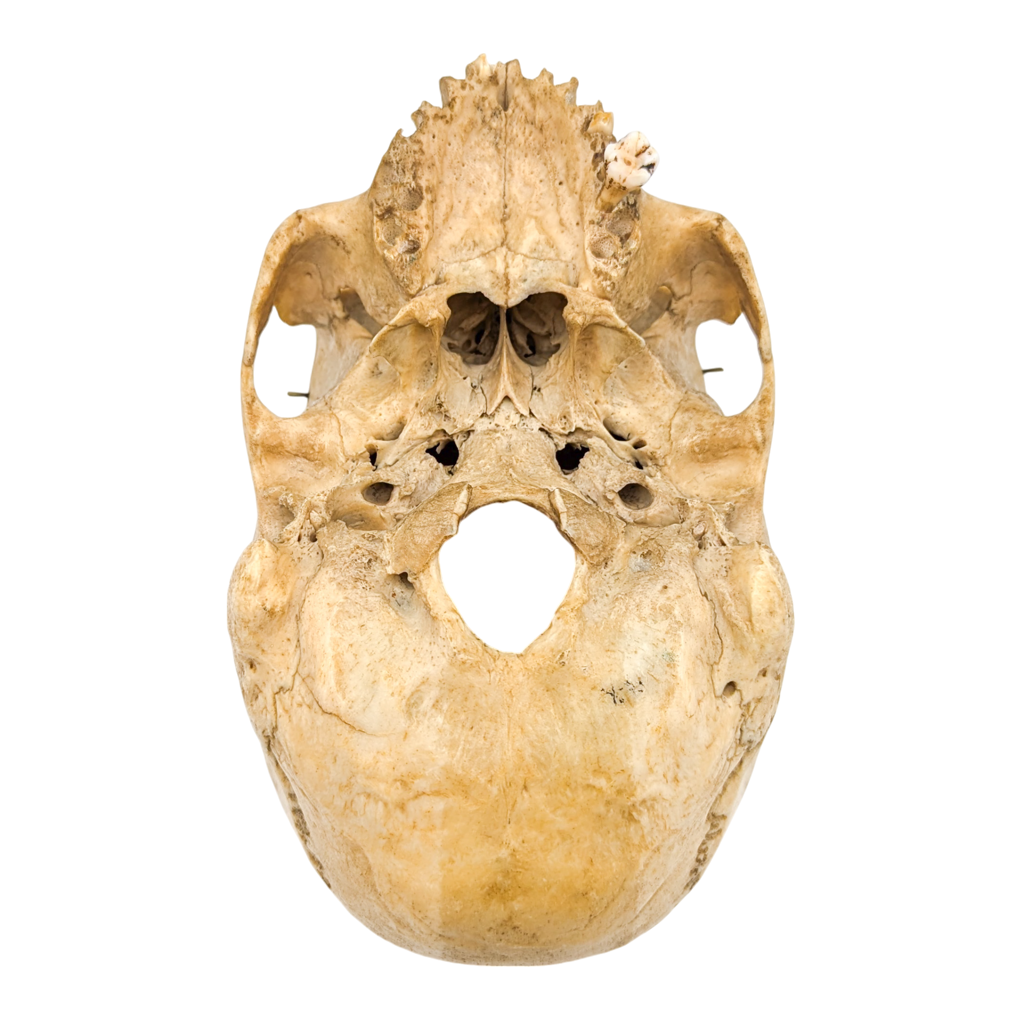 Real Partial Human Skull