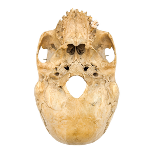 Real Partial Human Skull