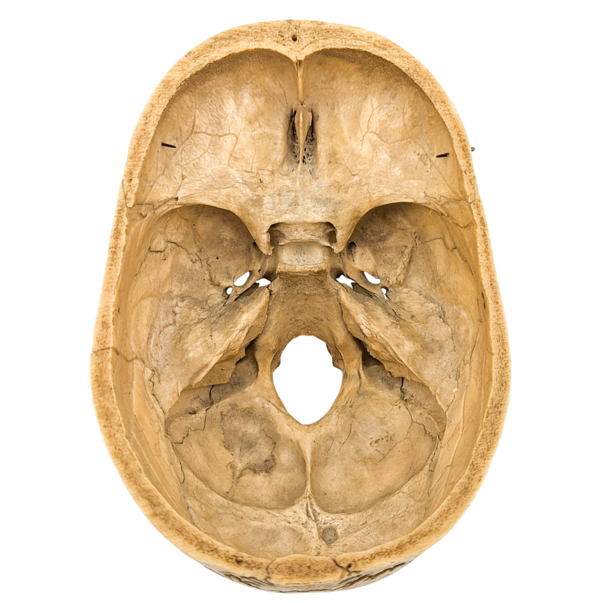 Real Partial Human Skull