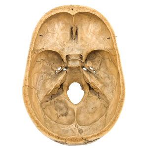 Real Partial Human Skull