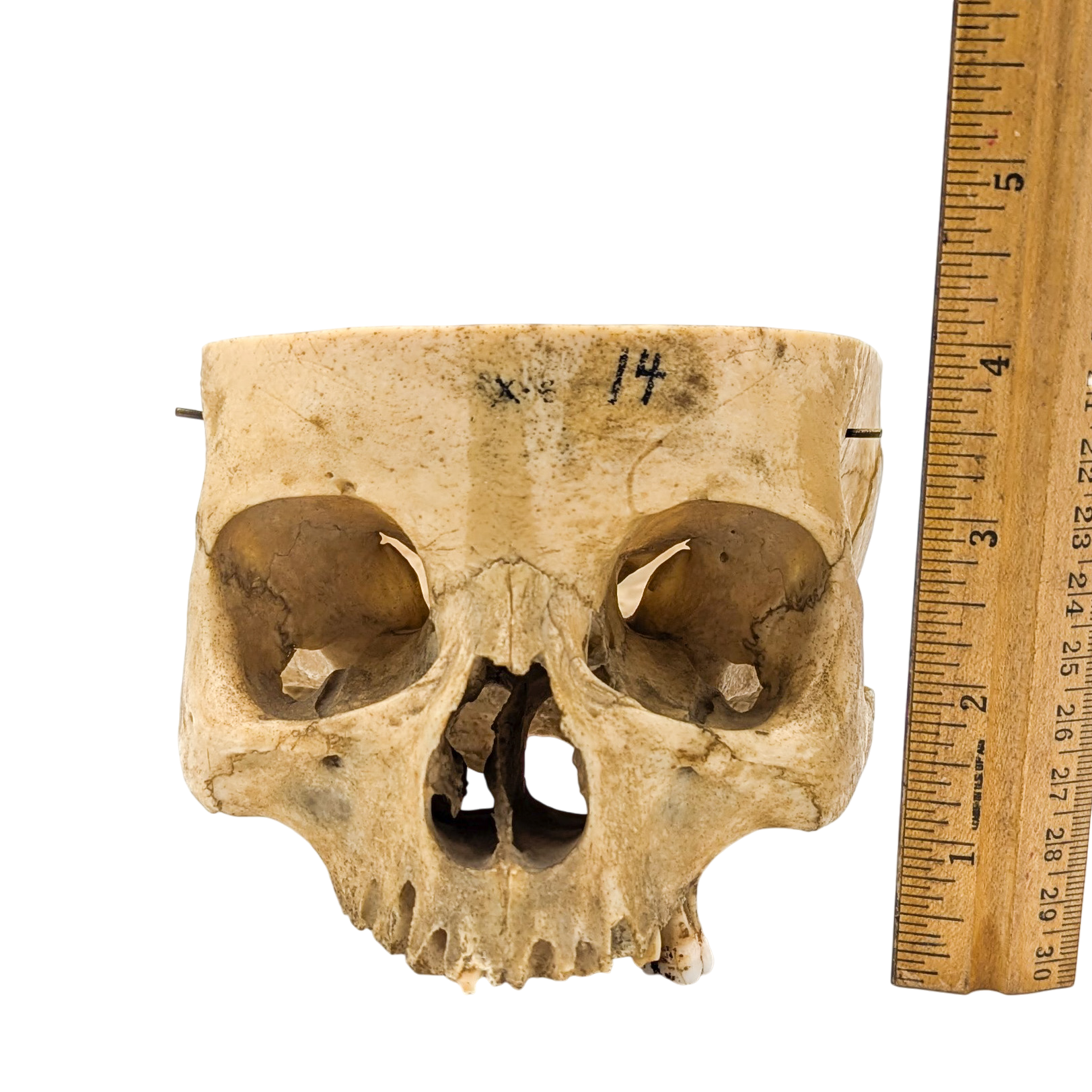 Real Partial Human Skull