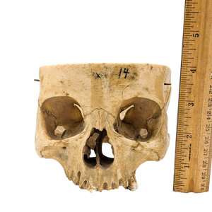 Real Partial Human Skull