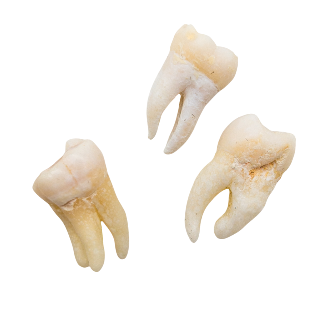 Real Human Tooth