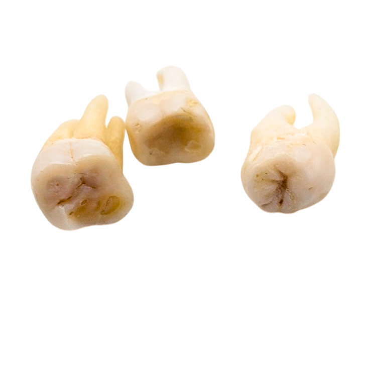 Real Human Tooth