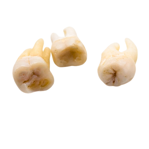 Real Human Tooth