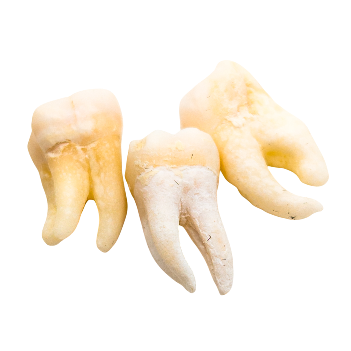 Real Human Tooth