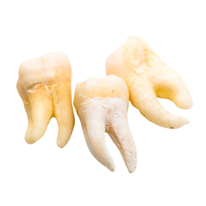 Real Human Tooth