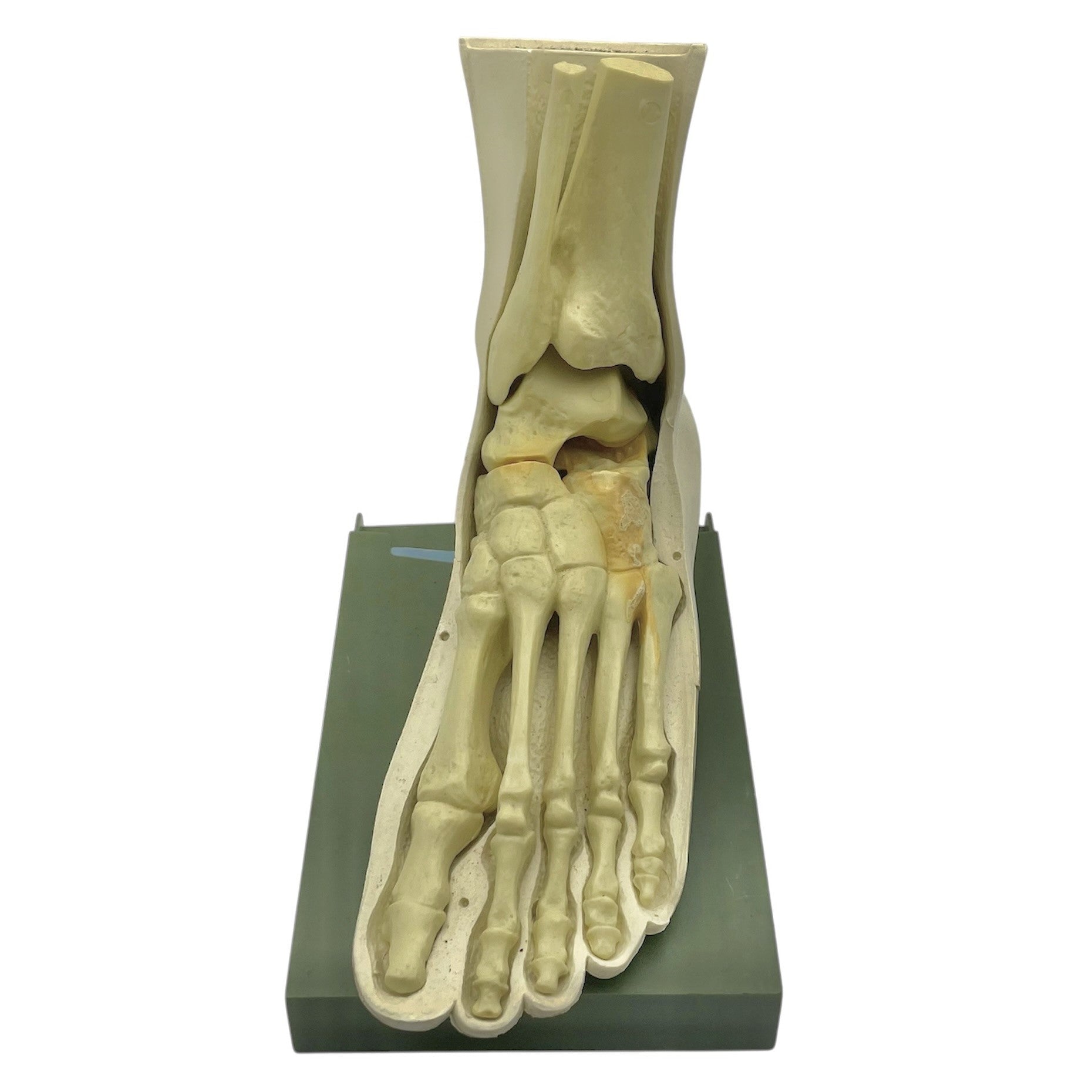 Vintage Human Foot Anatomical Model