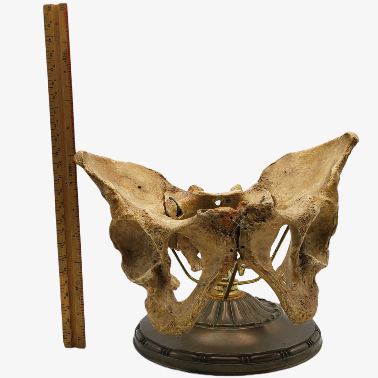 Genuine Human Pelvis & Sacrum