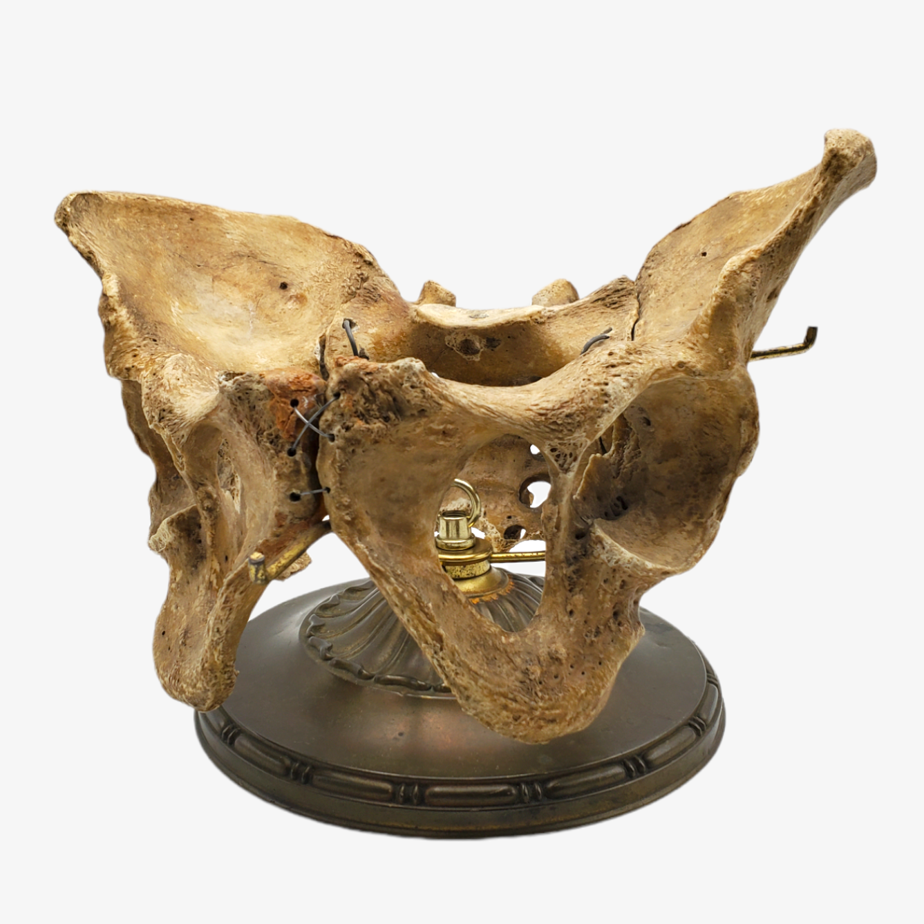 Genuine Human Pelvis & Sacrum