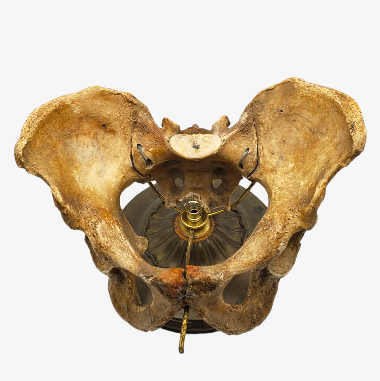 Genuine Human Pelvis & Sacrum